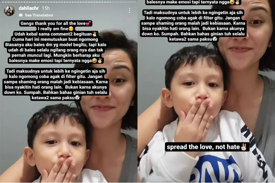 Wajahnya Dinyinyiri Warganet, Dahlia Poland: Kalau Aku Heboh Perawatan, Anak 3 Ditinggal sama Siapa? 4
