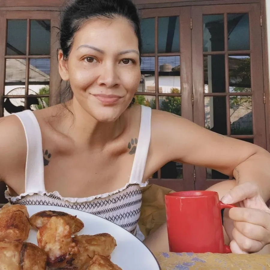 Melanie Subono Jalani Operasi Akibat Pecah Tumor, Ternyata Sudah Idap Puluhan Tahun 4