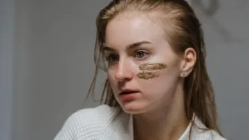 Trik Patch Test untuk Uji Alergi Kandungan Skincare. Penting, Biar Kulitmu Nggak Iritasi