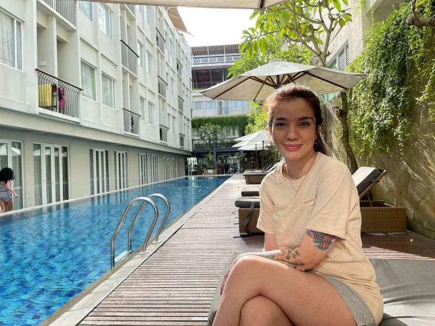 Sheila Marcia Bantah Dugaan KDRT Setelah Unggah Foto Wajah Lebam 6