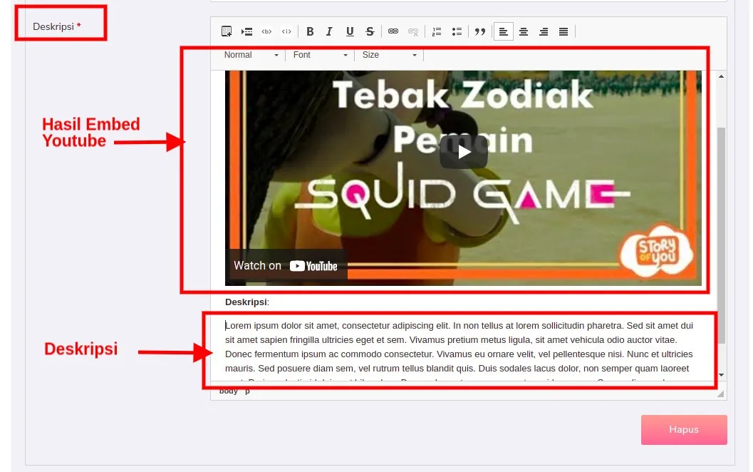 Yuk Kenalan dengan Fitur Baru, Listicle Gallery! Siap Menjadi Jembatan untuk Karyamu! 14