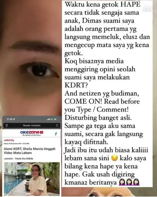 Sheila Marcia Bantah Dugaan KDRT Setelah Unggah Foto Wajah Lebam 4