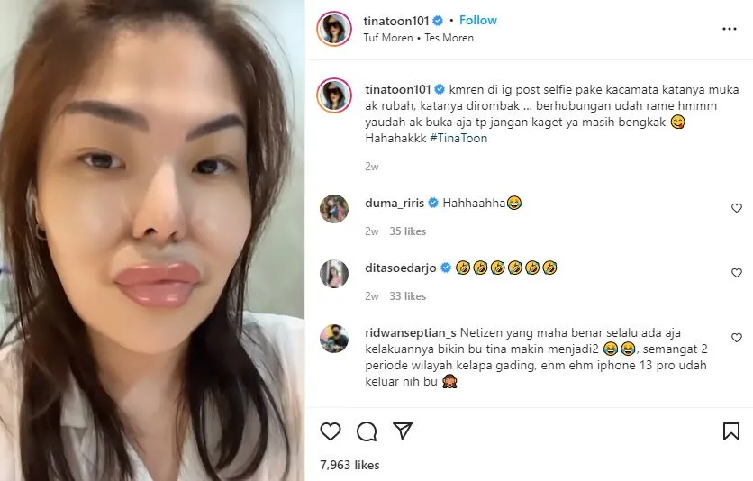 Tanggapan Tina Toon Terhadap Komentar Netizen Tentang Bentuk Wajahnya 4