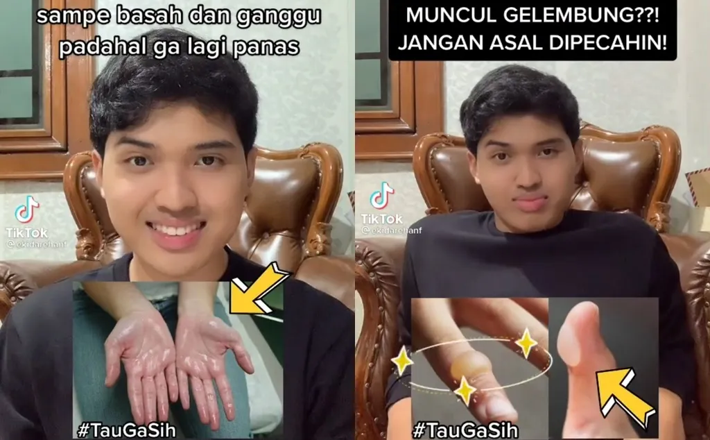 Konten Edukasi Kesehatan Antar Ekida Rehan Firmansyah Menangkan Challenge #TauGaSih TikTok Indonesia 4