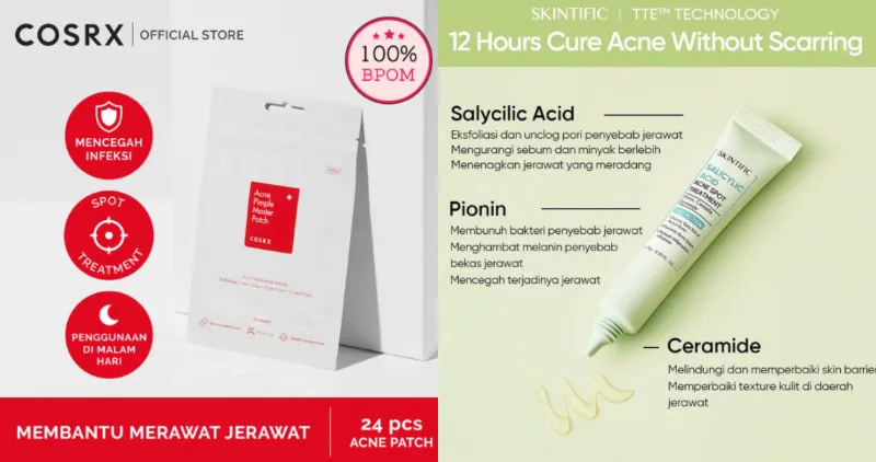Perbandingan Acne Patch vs Acne Spot Gel. Menurut Hipwee, yang ini Paling Ampuh! 8
