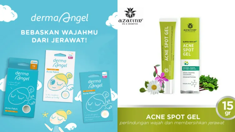 Perbandingan Acne Patch vs Acne Spot Gel. Menurut Hipwee, yang ini Paling Ampuh! 5
