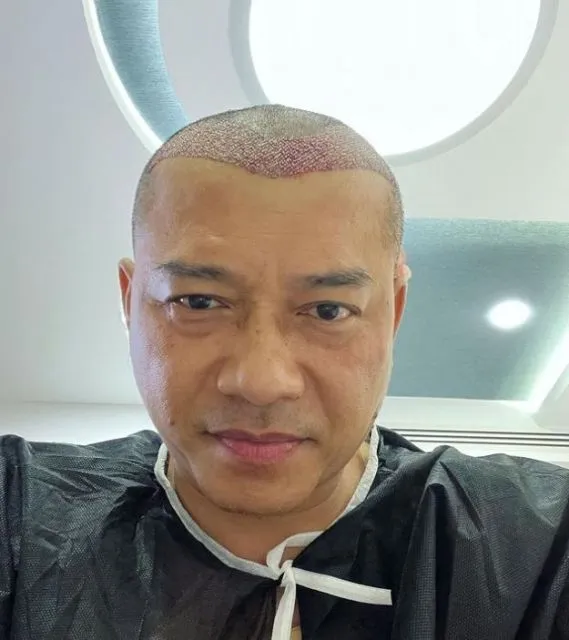 Anang Hermansyah Disebut Mirip Raul Lemos Usai Tampil Botak 3
