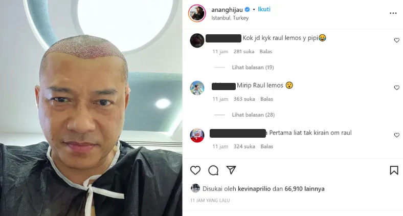 Anang Hermansyah Disebut Mirip Raul Lemos Usai Tampil Botak 4