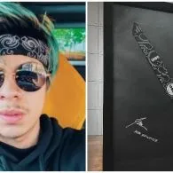 Atta Halilintar Lelang Headband Usai Transplantasi Rambut, Alasannya Mulia!