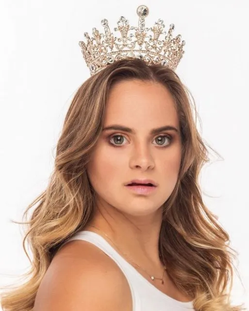 Sofia Jirau, Model Down Syndrome Pertama di Victoria's Secret 3 Sofia Jirau model Victoria's Secret