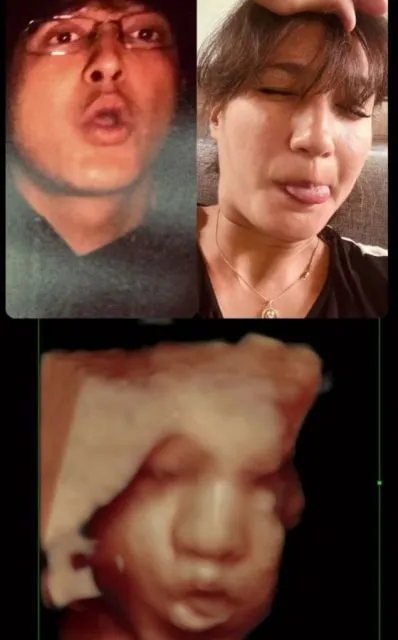 Nadine Chandrawinata dan Dimas Anggara Sambut Kelahiran Anak Pertama 4 Hasil USG Nadine Chandrawinata