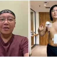 Ari Lasso Sembuh dari Kanker Usai Jalani 6 Sesi Kemoterapi
