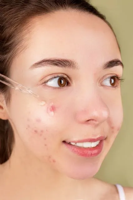 Mengenal Prickly Pear, Kandungan Skincare yang Punya Kemampuan Anti Aging 8 Pricky pear