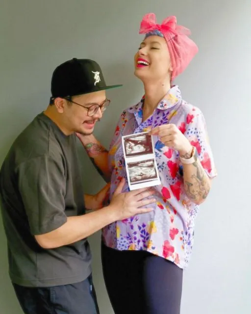 Istri Derby Romero Balas Sindiran karena Lahiran Secara Caesar: itu Pilihan Terbaik! 4 Derby Romero bersama sang istri, Claudia Adinda