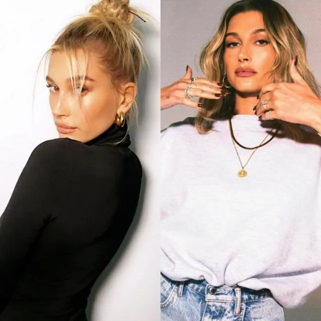 Hailey Bieber Alami Penggumpalan Darah di Otak, Gejalanya Mirip Stroke 4 Hailey Bieber masuk RS karena alami penggumpalan darah di otak