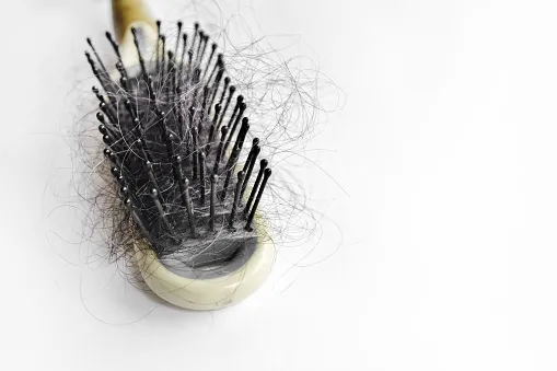 Rambut Bermasalah Bisa Jadi Tanda Tubuh Alami 6 Hal ini 9