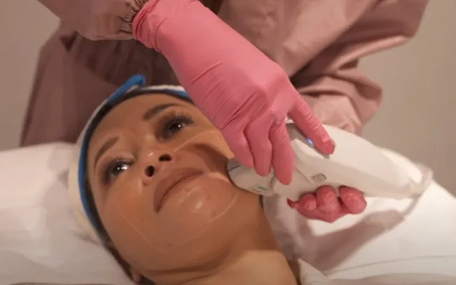 Maia Estianty Punya Klinik Kecantikan Sendiri, Berawal dari Sakit Kulit 4 Maia Estianty penyakit kulit