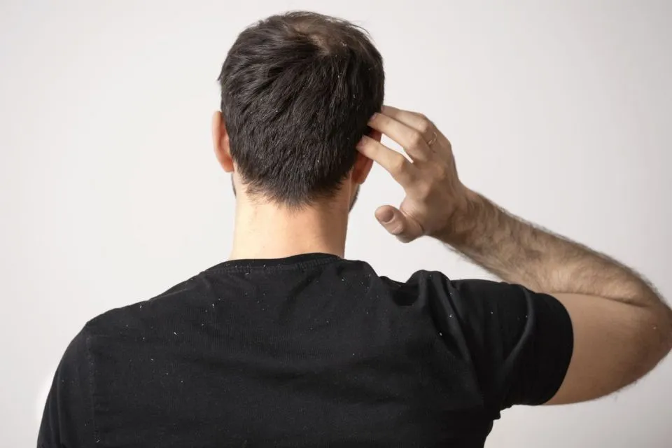 Rambut Bermasalah Bisa Jadi Tanda Tubuh Alami 6 Hal ini 10 Kondisi rambut bisa tunjukan kondisi tubuh