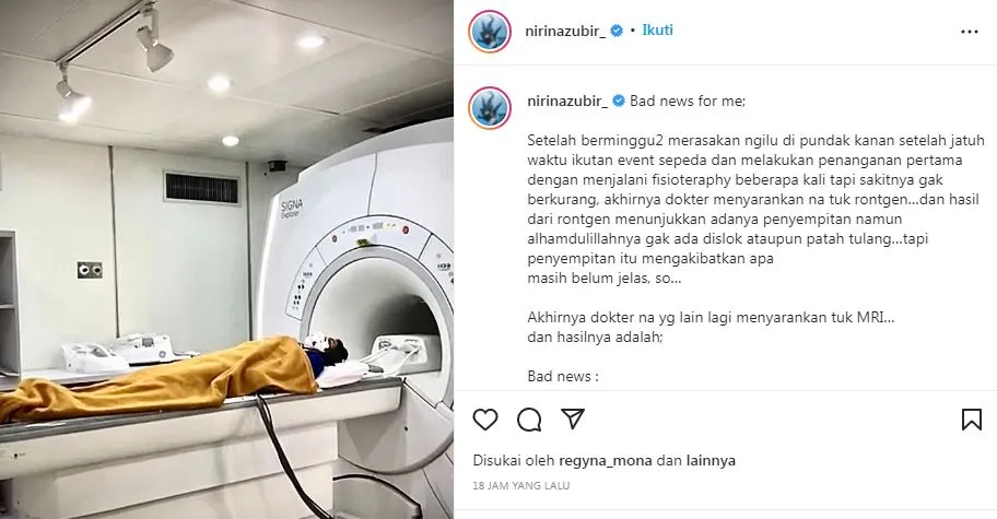 Nirina Zubir Alami Cedera Bahu Usai Jatuh dari Sepeda 3 Nirina