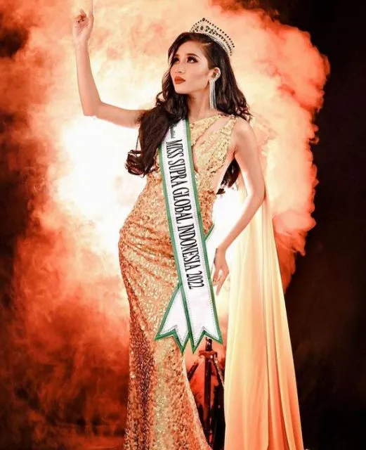 Potret Gaya Ryzia Sitorus, Pemenang Miss Supraglobal 2022 Asal Indonesia 8