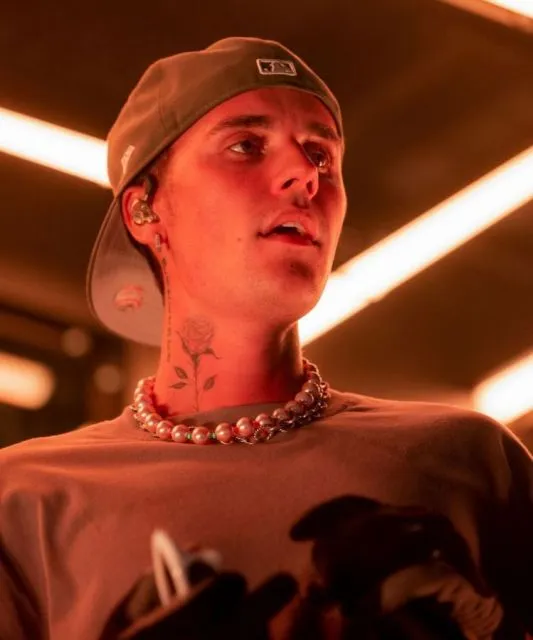 Justin Bieber Kena Sindrom Langka Ramsay Hunt, Wajahnya Lumpuh Sebelah 2