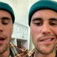 Justin Bieber Kena Sindrom Langka Ramsay Hunt, Wajahnya Lumpuh Sebelah