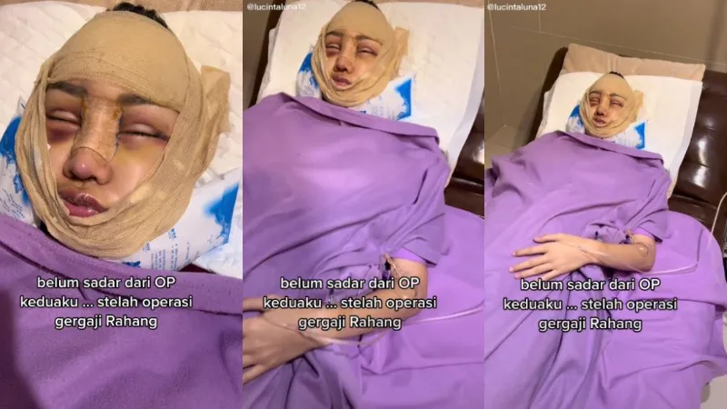 Sederet Operasi yang Dilakukan Lucinta Luna: Potong Leher hingga Potong Tulang Ekor 6 Operasi yang dijalani lucinta luna