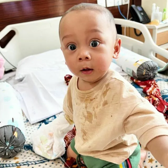 Rizky Billar Ungkap Kondisi Anak Usai Operasi, Sebut Fatih Idap Hernia Inguinalis 6 Hernia Inguinalis yang diderita Fatih
