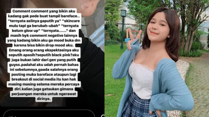 Unggah Foto Tanpa Make Up, Brisia Jodie Kena Bully: Orang Ekspektasinya Aku Seputih Apa? 4