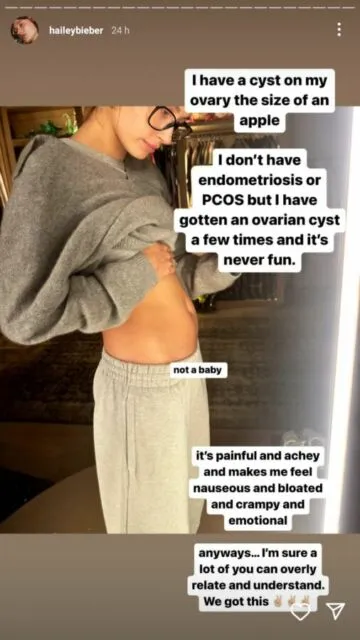 Bantah Rumor Hamil, Hailey Baldwin Cerita Idap Kista Ovarium Seukuran Apel 3 Hailey mengidap kista ovarium
