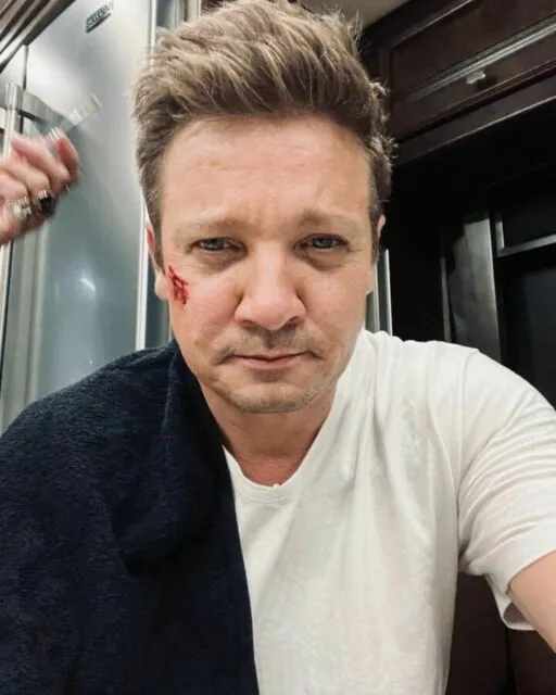 Jeremy Renner Unggah Foto dari Rumah Sakit Usai Kecelakaan, Wajah Masih Bengkak dan Memar 4 Potret Jeremy Renner