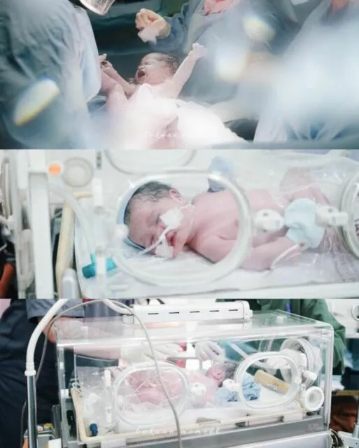 Cerita Tasya Kamila Melahirkan Anak Kedua dengan Metode ERACS, Alami Alergi dan Pemulihan Lambat 8 Bayi kedua Tasya, Shafanina Wardhana Bachtiar