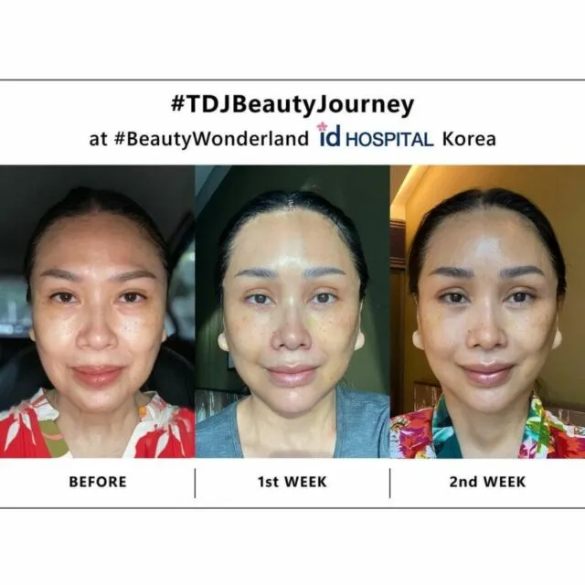Titi DJ Blak-blakan Soal Operasi Anti Aging, Bikin Penampilanya Lebih Muda 4 Titi Dj