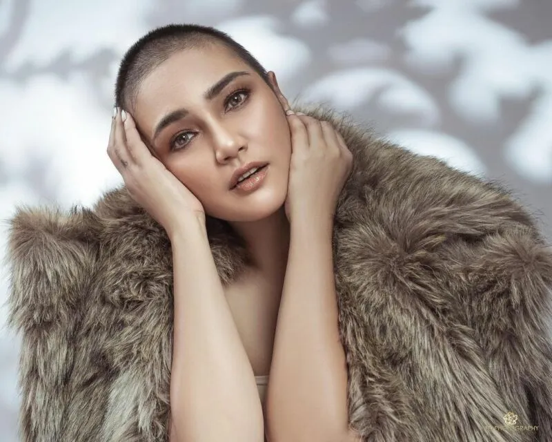 Selain Melaney Ricardo, 6 Artis Indonesia ini Juga Lakukan Operasi Pengangkatan Rahim 10 Feby Febiola operasi angkat rahim