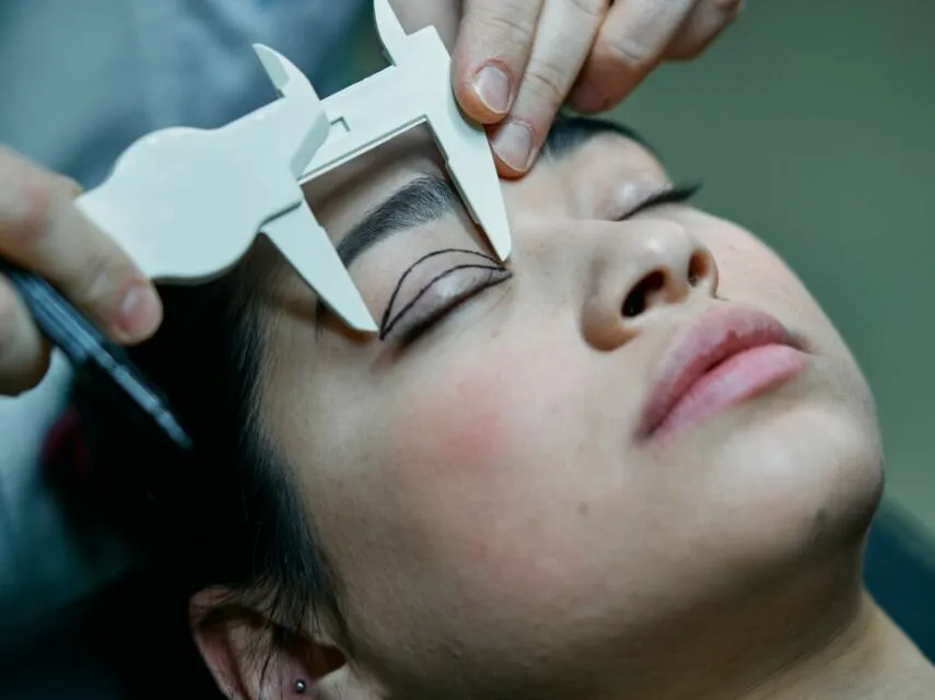 5 Rangkaian Operasi Anti Aging yang Dilakukan Titi DJ. Cantik Itu Butuh Pengorbanan! 9 Lower blepharoplasty