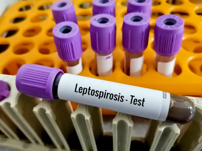 Cara Mencegah Leptospirosis, Penyakit Kencing Tikus yang Mewabah di Musim Hujan! 3 leptospirosis