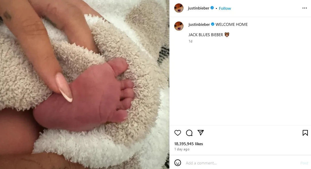 Hailey Baldwin Melahirkan, Justin Bieber Akhirnya Resmi Jadi Ayah. Selamat! 2