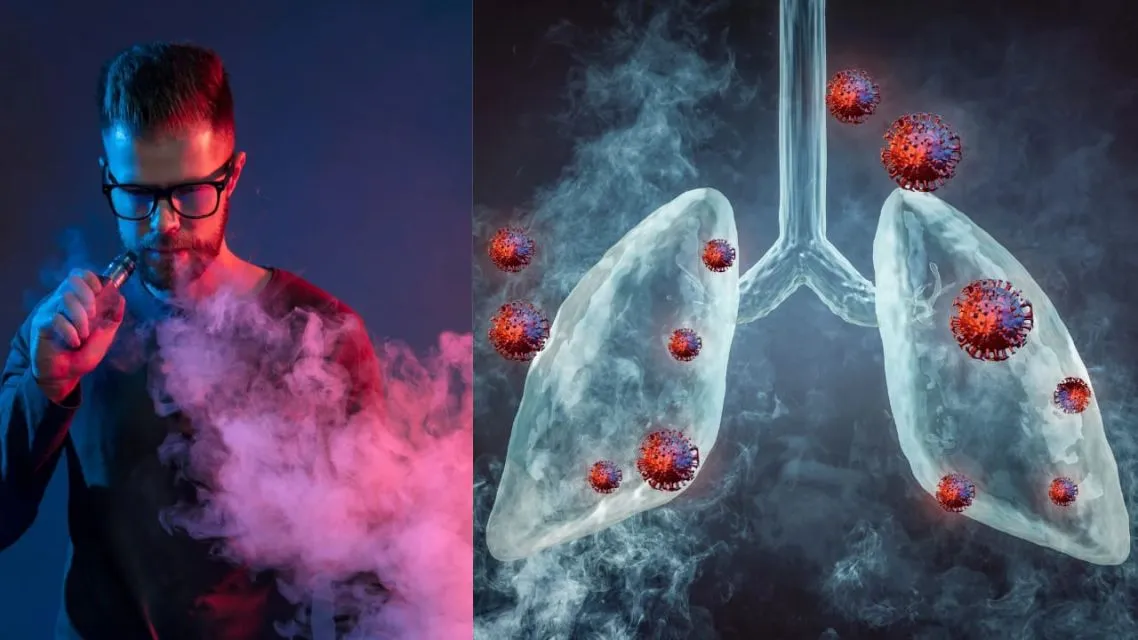 5 Fakta Mengerikan Vape: Setara Narkoba di Singapura, Tapi Masih Jadi Tren Anak Muda Indonesia 11 Vape setara narkoba-merusak paru-paru lebih licik