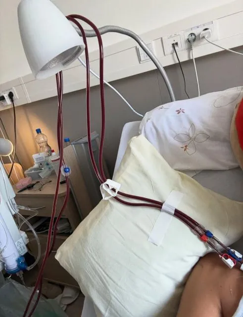 5 Fakta Mengejutkan Seputar Lyme Disease Bella Hadid yang Wajib Diketahui Sebagai Bentuk Awareness 14 tidak semua bisa sembuh total
