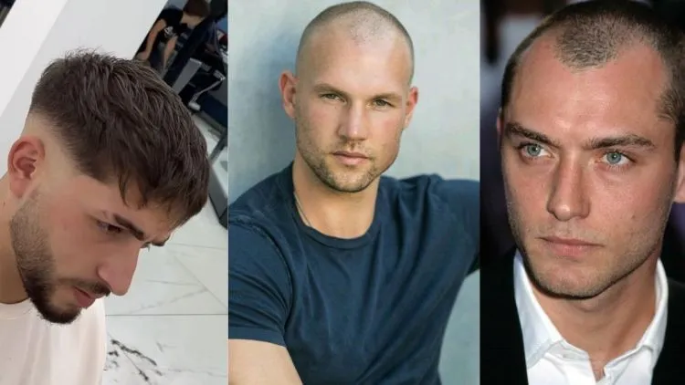 8 Gaya Rambut Pria Botak Depan Agar Tetap Kece dan Pede!